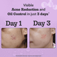 Chemist At Play 2% Salicylic Acid Serum