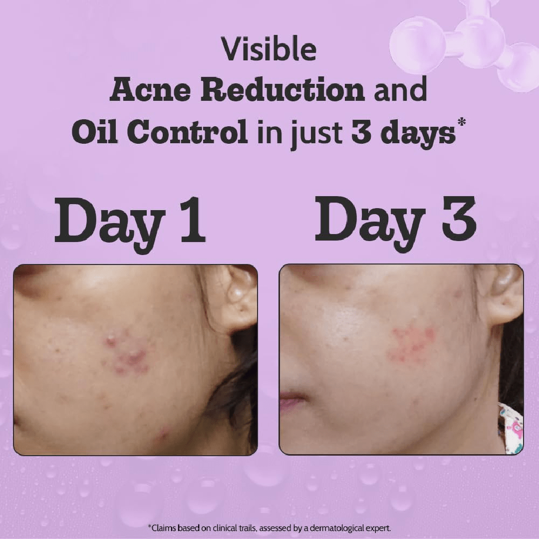 Chemist At Play 2% Salicylic Acid Serum