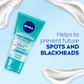 NIVEA Stop Pimples Daily Wash Scrub – 150ml