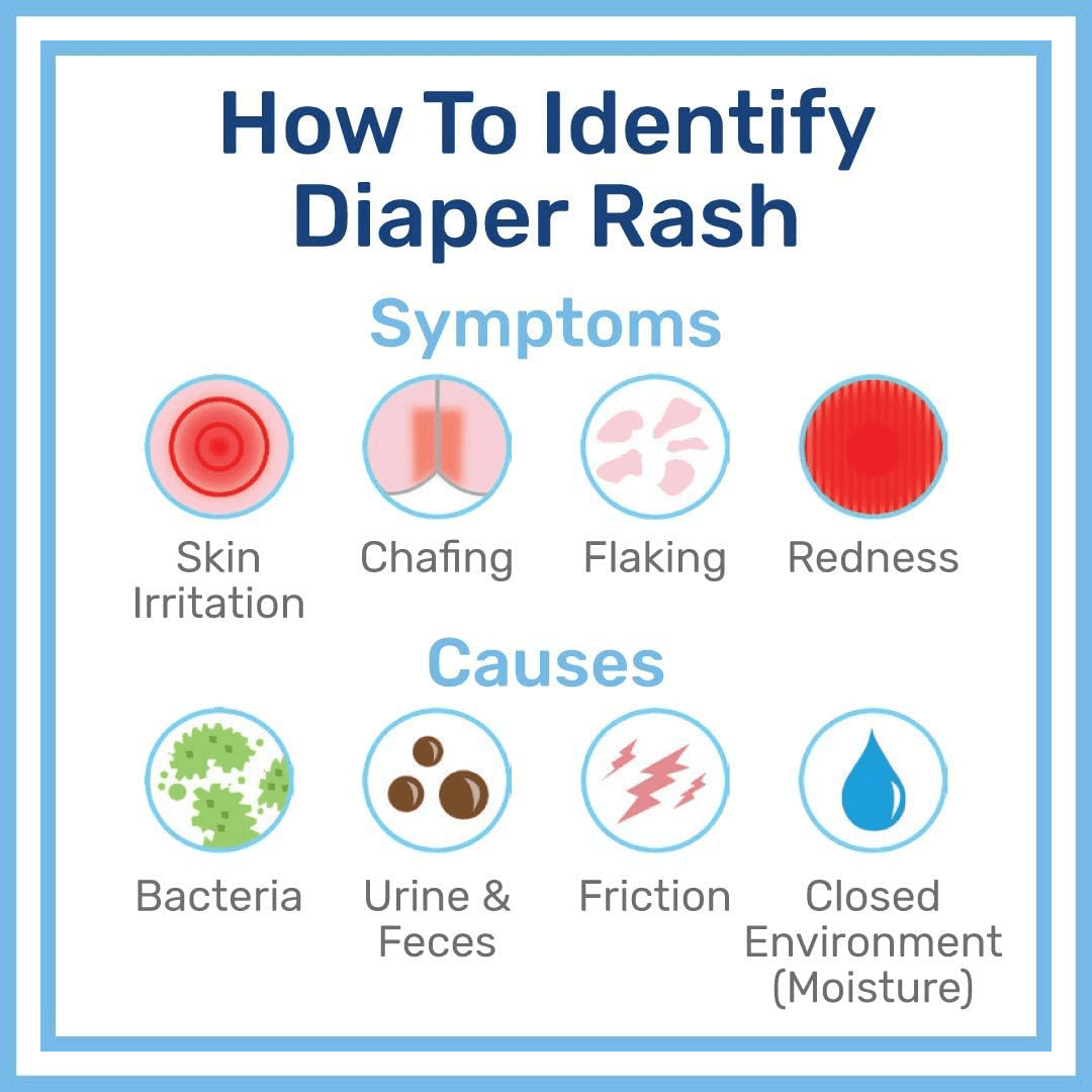 (Discounted Product) Penaten Medicated Diaper Rash Cream – 454 g