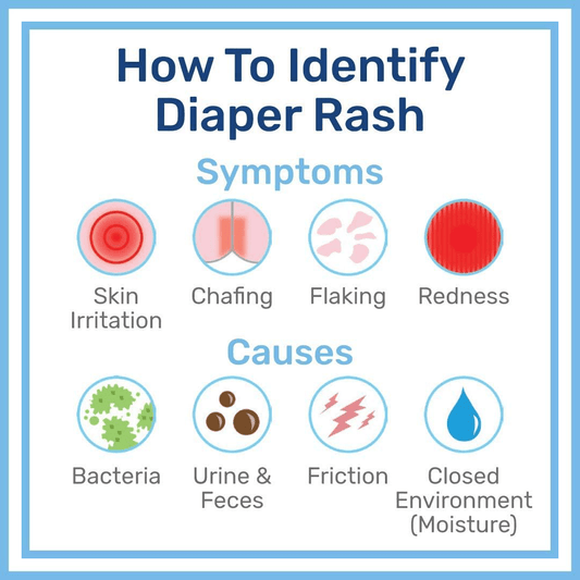 (Discounted Product) Penaten Medicated Diaper Rash Cream – 454 g