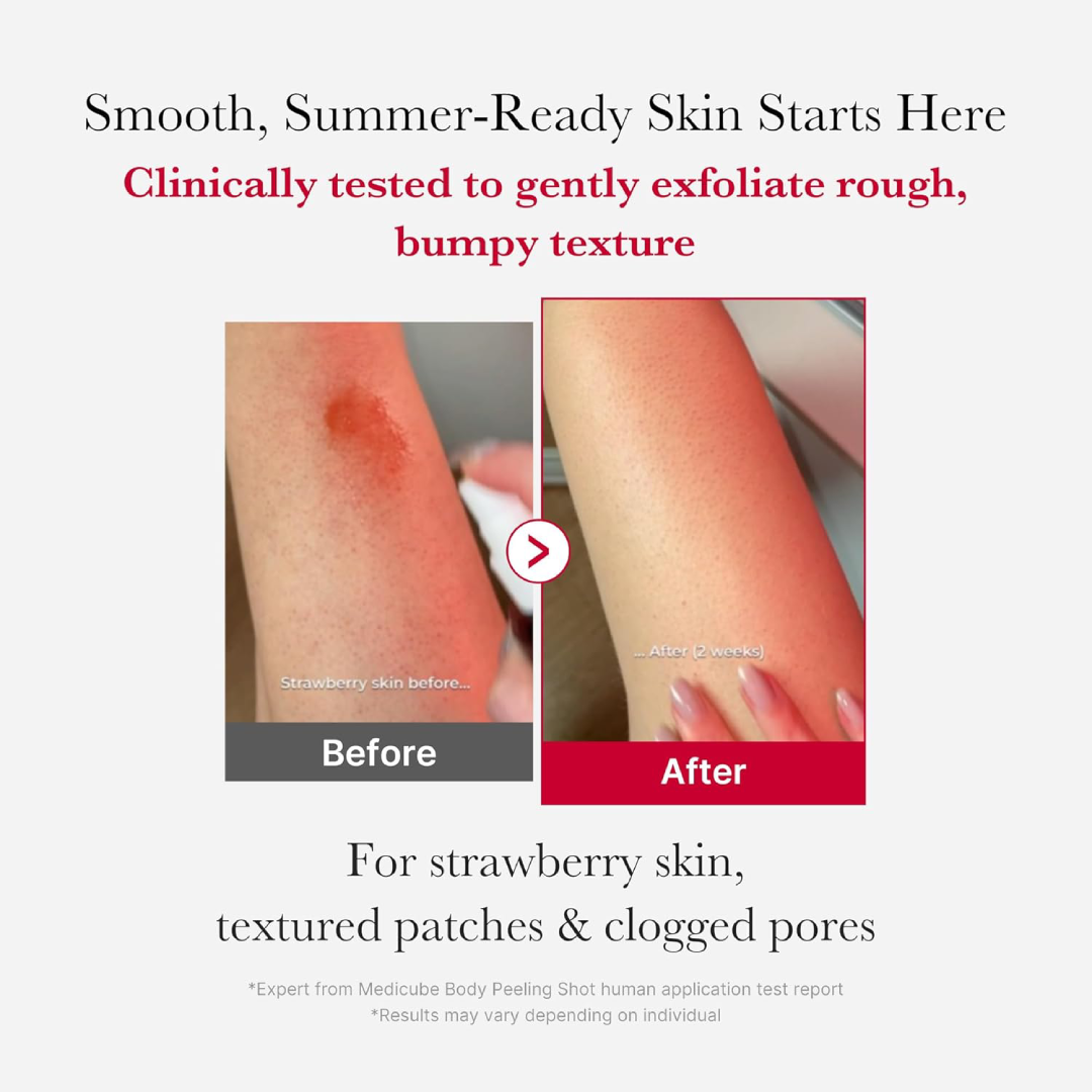 Medicube Red Body Peeling Shot Strawberry Spray 110g