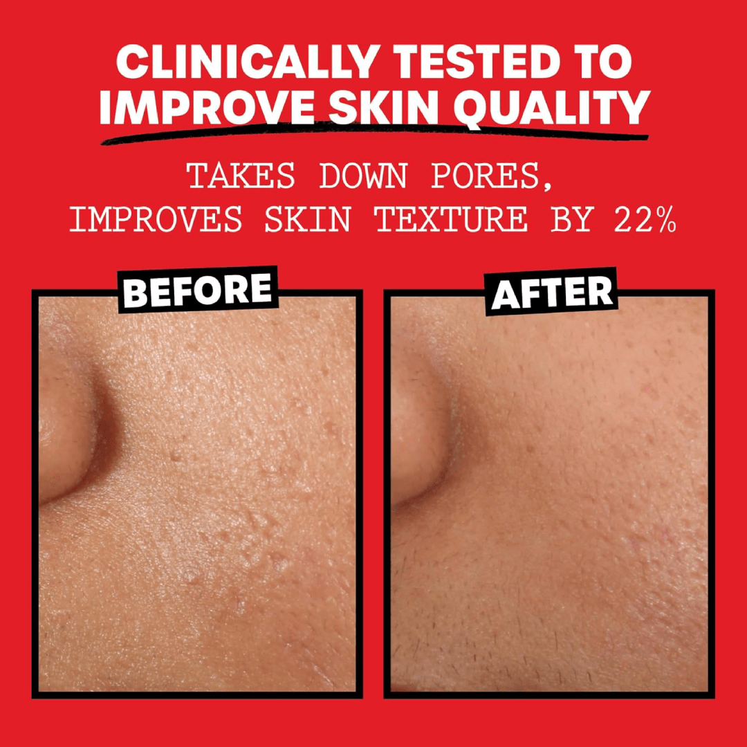 Thayers Alcohol-Free Rose Petal Witch Hazel Toner (12oz)