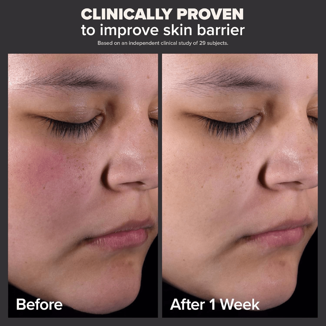 Paula’s Choice 2% BHA Liquid Exfoliant