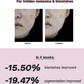 COSRX The Niacinamide 15 Serum 20ml