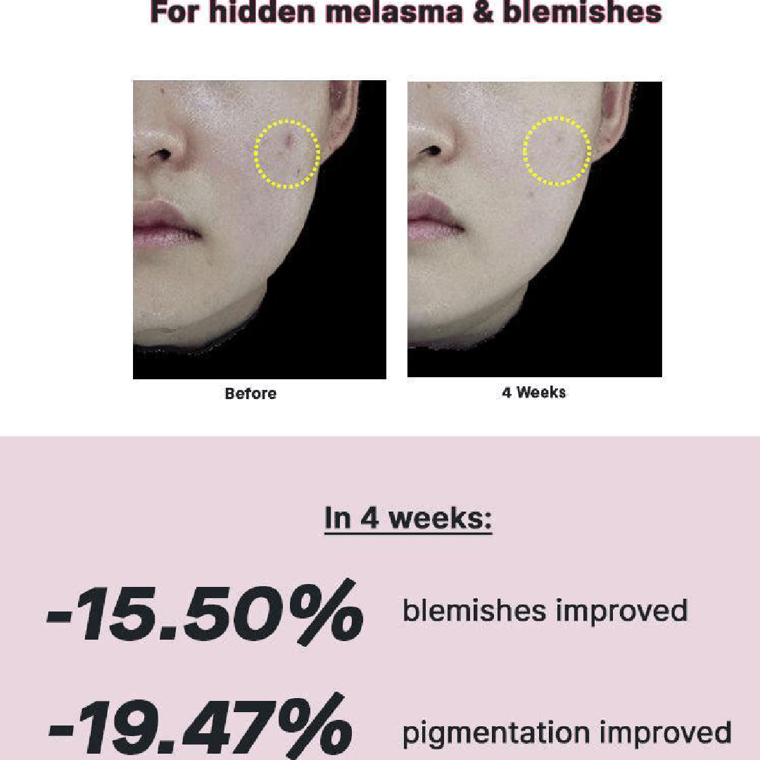 COSRX The Niacinamide 15 Serum 20ml