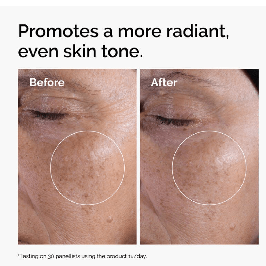 The Ordinary Glycolic Acid 7% Toning Solution