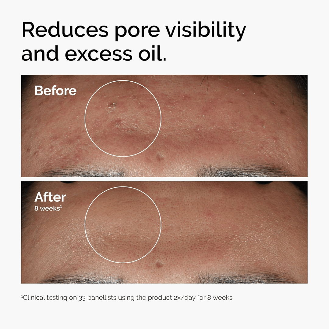 The Ordinary Niacinamide 10% + Zinc 1% – 60ml