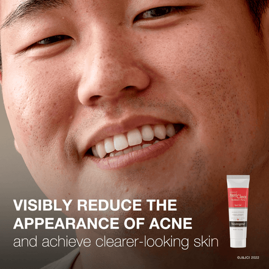 Neutrogena Rapid Clear Stubborn Acne Spot Gel 28g