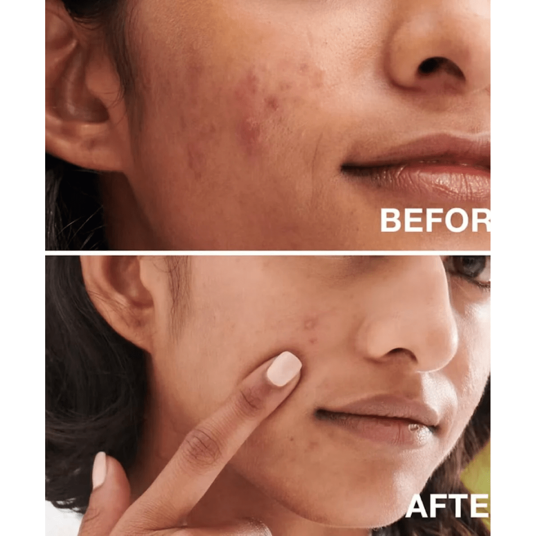 Neutrogena Oil-Free Acne Wash 269ml
