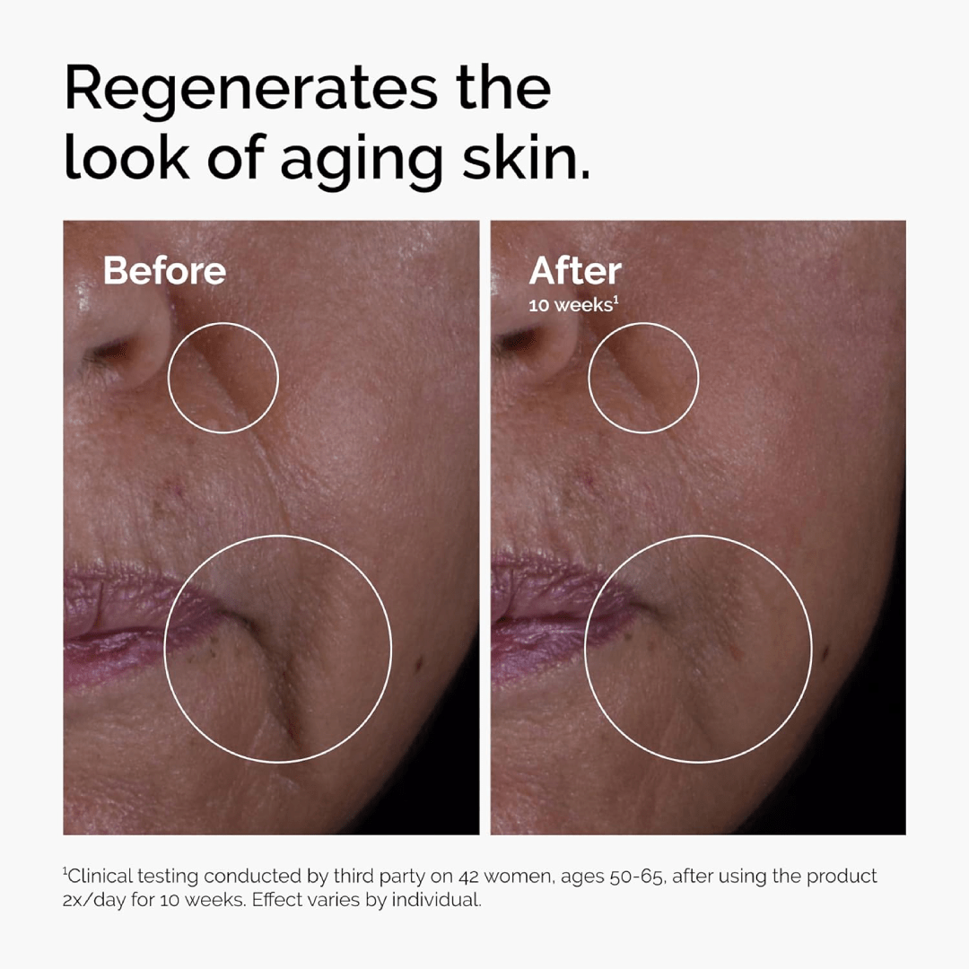 The Ordinary GF 15% Solution – 30ml