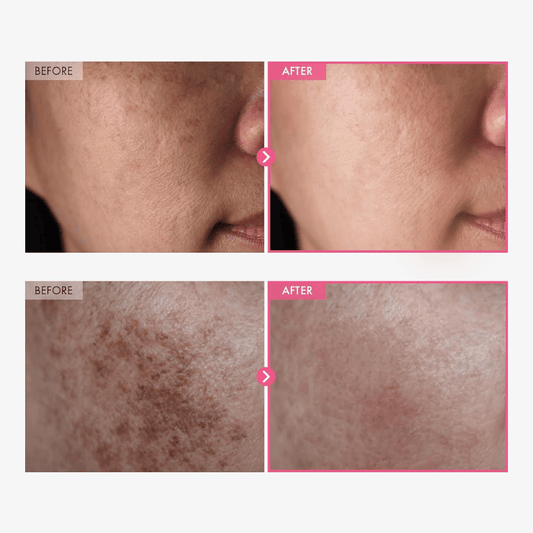 TOSOWOONG Arbutin 7% + Tranexamic Acid 4% Cream – 50ml