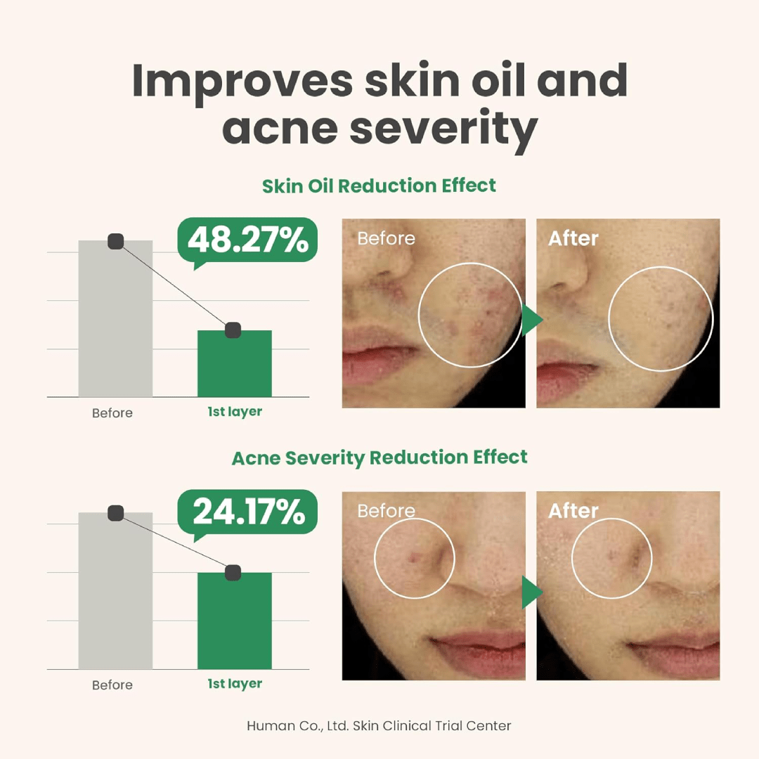 AXIS-Y Spot The Difference Blemish Treatment 15ml
