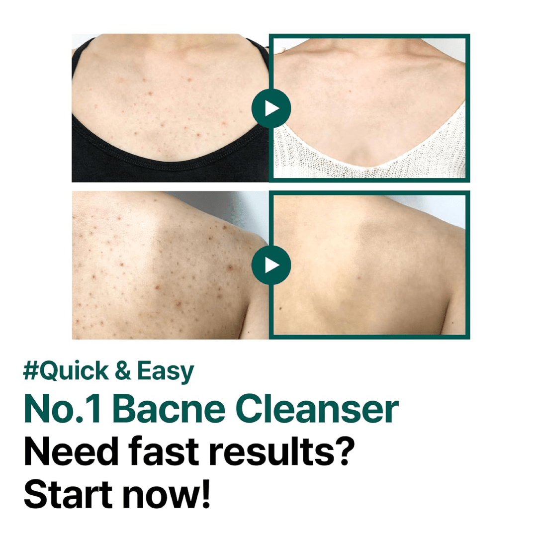 Some By Mi AHA BHA PHA Body Cleanser 400g