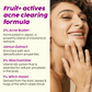 Plix Jamun Active Acne Moisturizer 50g