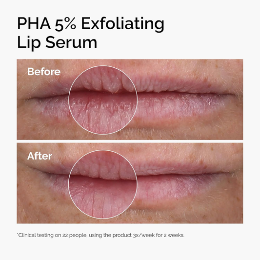 The Ordinary PHA 5% Exfoliating Lip Serum – 15ml
