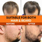 Kirkland Minoxidil 5% Hair Regrowth Solution (1 Month Supply)