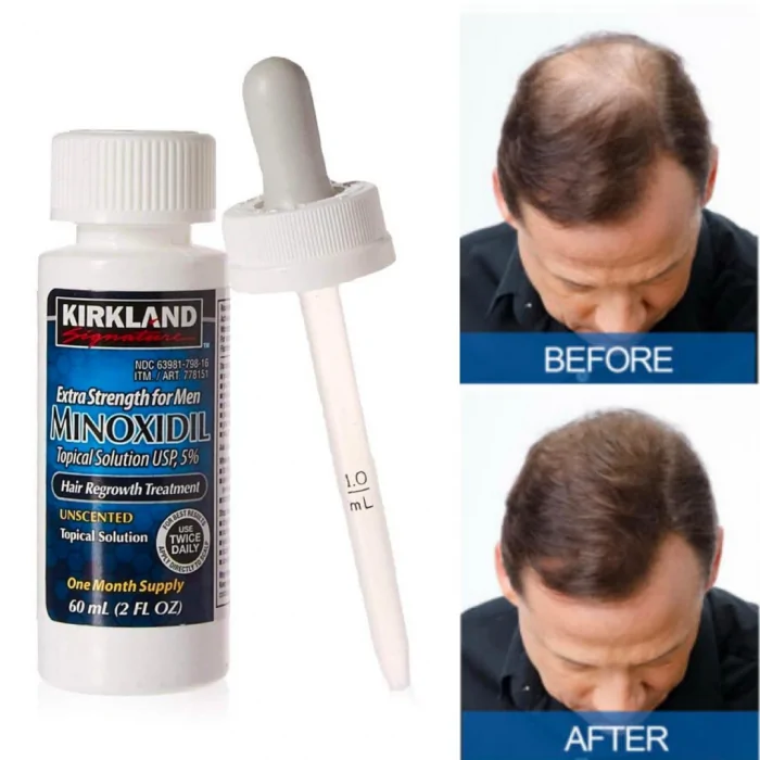 6 Months Kirkland Minoxidil 5% Extra Strength Hair Loss Regrowth Treatment Men - Image 8