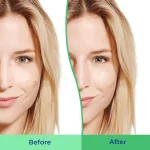 (Discounted Product ) Differin Acne Face Wash with 5% Benzoyl Peroxide - Image 2