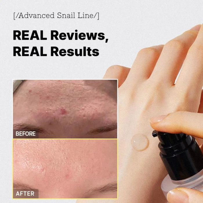 COSRX Advanced Snail 96 Mucin Power Essence 100ml - Image 4