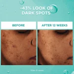 L'Oréal Paris Bright Reveal Dark Spot Face Serum | 12% Niacinamide + Ferulic + Amino Sulfonic Acids | 30mL - Image 2