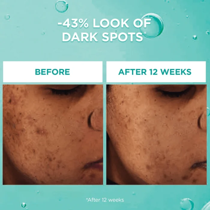 L'Oréal Paris Bright Reveal Dark Spot Face Serum | 12% Niacinamide + Ferulic + Amino Sulfonic Acids | 30mL - Image 2