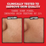 Thayers Alcohol-Free Rose Petal Witch Hazel Facial Toner for Glowing Skin, Soothing, Hydrating, Refreshing Toner for Normal and Combination Skin, 12oz - Image 5