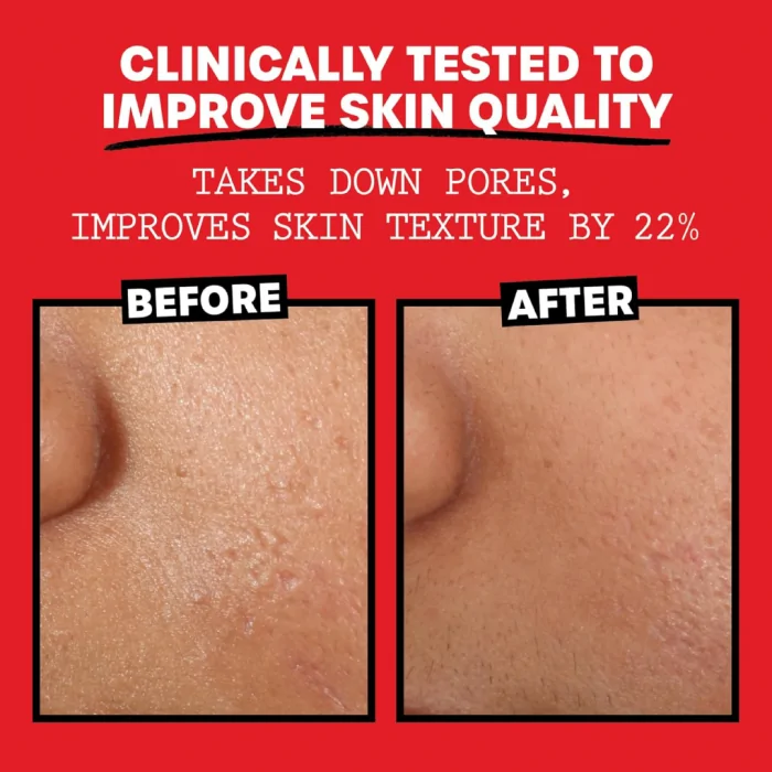 Thayers Alcohol-Free Rose Petal Witch Hazel Facial Toner for Glowing Skin, Soothing, Hydrating, Refreshing Toner for Normal and Combination Skin, 12oz - Image 5