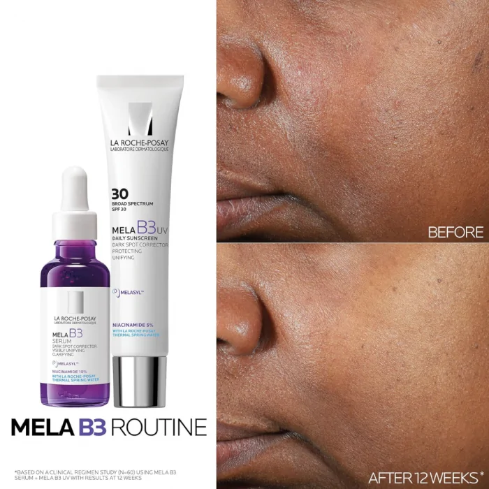 La Roche-Posay Mela B3 Serum, Dark Spot Corrector With Anti-Aging Melasyl + 10% Niacinamide, Discoloration Correcting Serum for Sun Spots, Age Spots & Post-Acne Marks, 30ML - Image 2