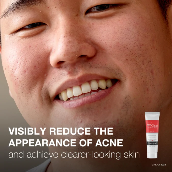 ( Discounted Product ) NEUTROGENA® RAPID CLEAR® Stubborn Acne Spot Gel 28g - Image 3