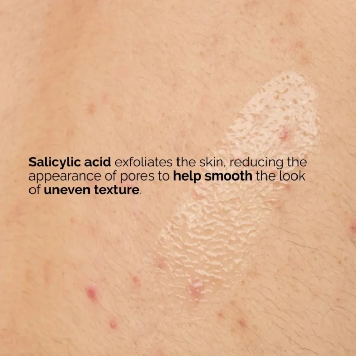 The Ordinary  Salicylic Acid 0.5% Body Serum  240ml - Image 5
