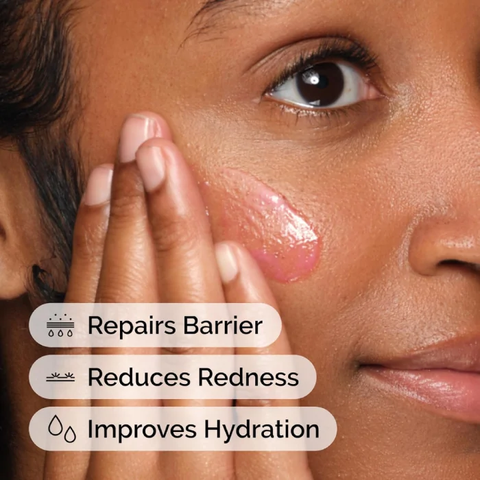 The Ordinary Soothing & Barrier Serum Support 30ml - Image 3