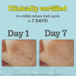 Chemist At Play 10% Vitamin C Face Serum _Brightens & Gives Glow _Fades Dark Sp