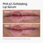 The Ordinary PHA 5% Exfoliating Lip Serum, Hydrating Overnight Lip Exfoliator Treatment, 15ml (3)