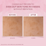 Cetaphil Brightening Night Comfort Cream - 50 g_ For Dark Spots, Uneven Skin Tone_ Hyaluronic Acid & Niacinamide (1)