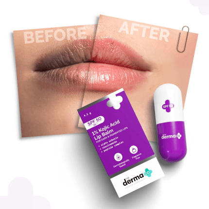 The Derma Co 1% Kojic Acid Lip Balm with SPF 50 PA+++ with Arbutin & Peptide Complex